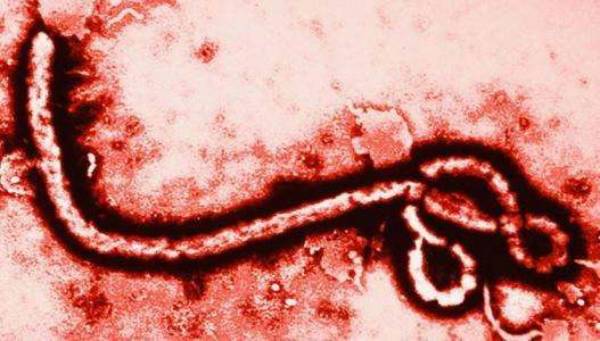 埃博拉病毒的样子图片